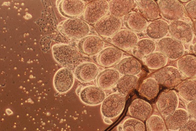 Imatge microscòpica de larves